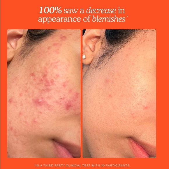 Tower 28 Skin Rescue Solution Mini Size - Picture 2 of 4